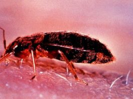 Where Do Bed Bugs Hide On Your Body? Lets Find Out