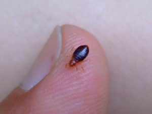 Where Do Bed Bugs Hide On Your Body? Lets Find Out