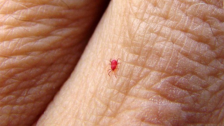 Chiggers vs Scabies