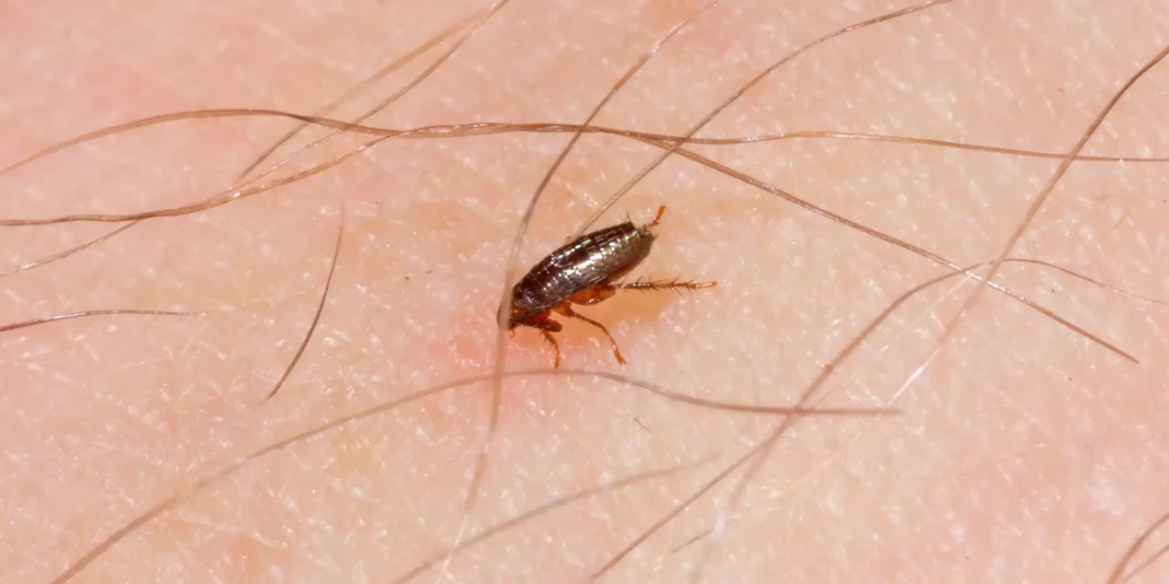 Home Remedies For Flea Bites 