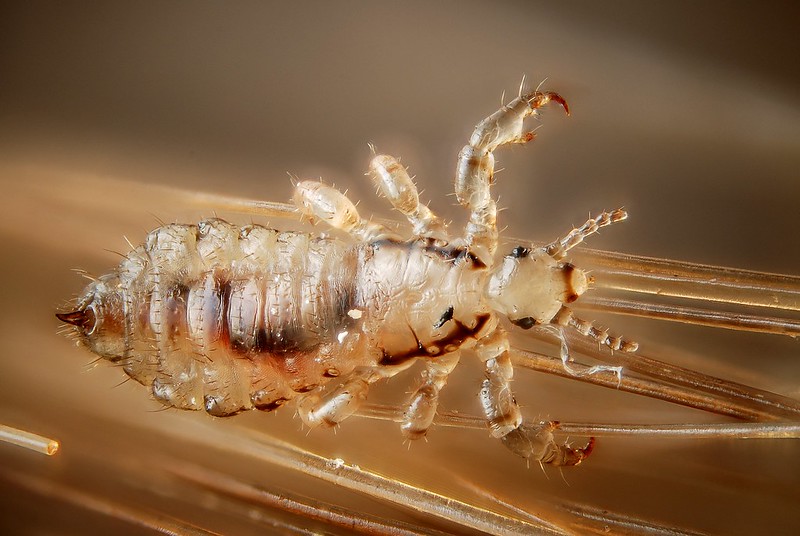 Bed Bugs vs Lice Bites